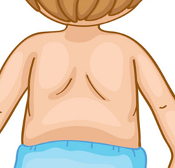 Back
